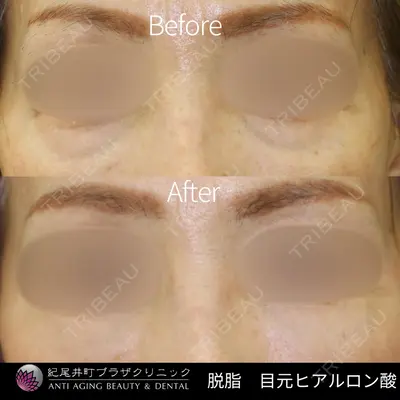 紀尾井町プラザクリニック 石原 久子医師の症例