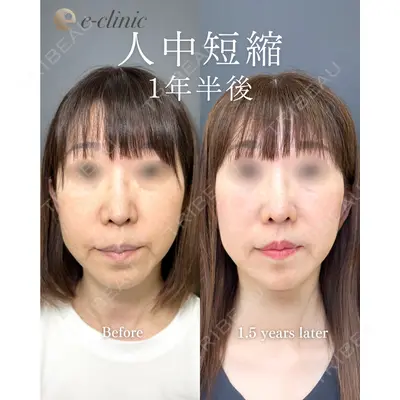 eクリニック 福岡院 伊藤 渉医師の症例