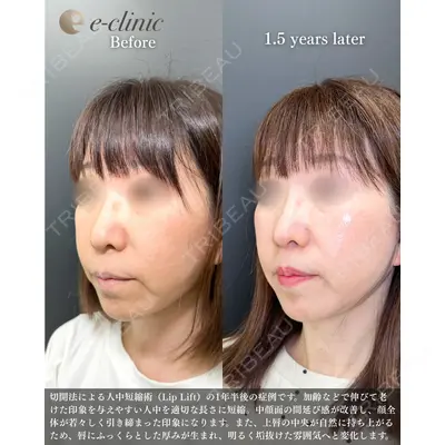 eクリニック 福岡院 伊藤 渉医師の症例