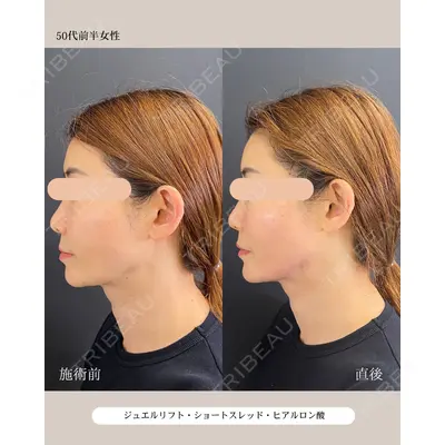 自由が丘ウェルエイジングビューティークリニック 福田 知佐子医師の症例