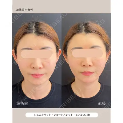 自由が丘ウェルエイジングビューティークリニック 福田 知佐子医師の症例