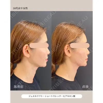 自由が丘ウェルエイジングビューティークリニック 福田 知佐子医師の症例
