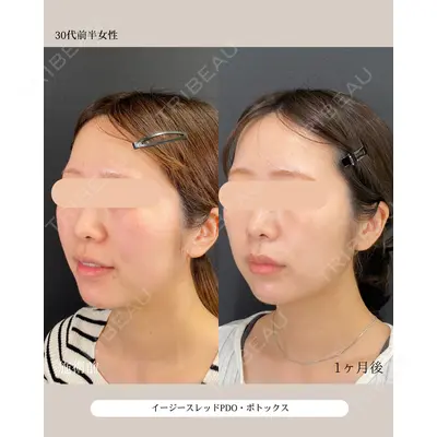 自由が丘ウェルエイジングビューティークリニック 福田 知佐子医師の症例