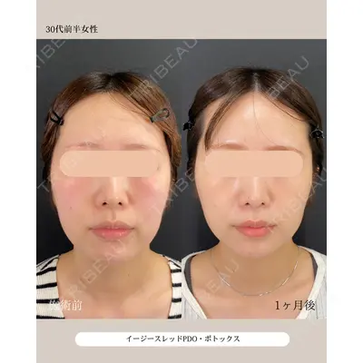 自由が丘ウェルエイジングビューティークリニック 福田 知佐子医師の症例