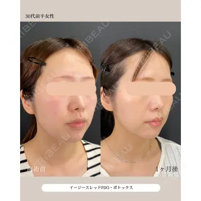 自由が丘ウェルエイジングビューティークリニック 福田 知佐子医師の症例