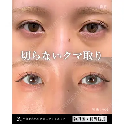 小倉美容外科ネビュラクリニック 浦野 正樹医師の症例