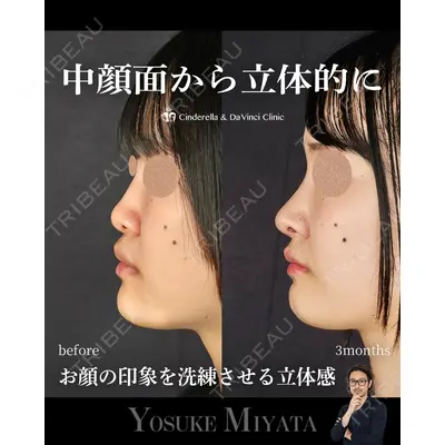 シンデレラ＆ダヴィンチクリニック 宮田 洋佑医師の症例