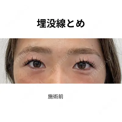 おおたかの森ビューティークリニックthe art 下間　佳奈医師の症例