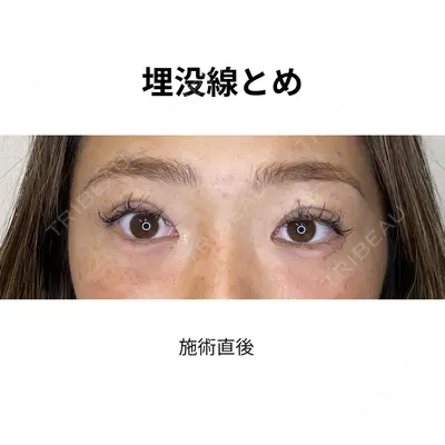 おおたかの森ビューティークリニックthe art 下間　佳奈医師の症例