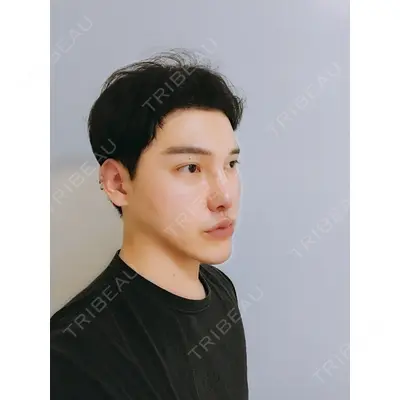 DA美容外科 LEE SANG WOO医師の症例