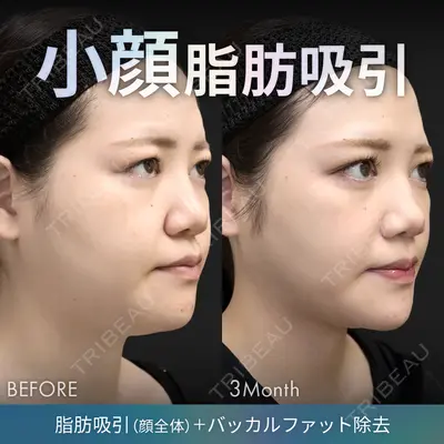 ジョウクリニック 銀座院 重本　譲医師の症例