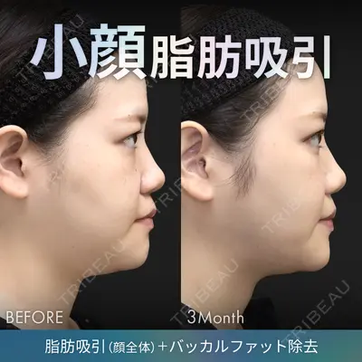 ジョウクリニック 銀座院 重本　譲医師の症例
