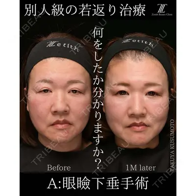 Zetith Beauty Clinic 大阪心斎橋院 楠本 拓哉医師の症例