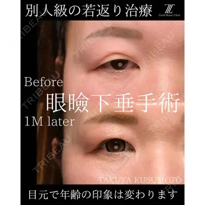 Zetith Beauty Clinic 大阪心斎橋院 楠本 拓哉医師の症例
