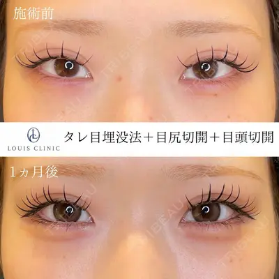 LOUIS CLINIC 二子玉川院【ルイクリニック】 小松 塁医師の症例