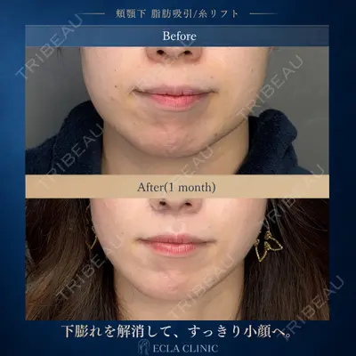ECLA CLINIC (エクラクリニック) 緒方 善孝医師の症例