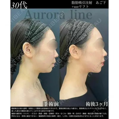 湘南美容クリニック 川崎院の症例