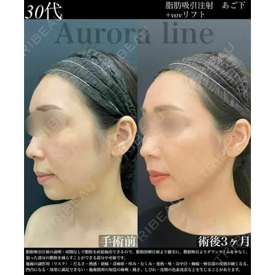 湘南美容クリニック 川崎院の症例