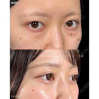 新宿美容外科ネビュラクリニック 山本 紘子医師の症例
