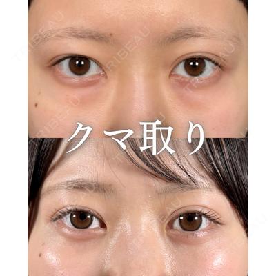 新宿美容外科ネビュラクリニック 山本 紘子医師の症例