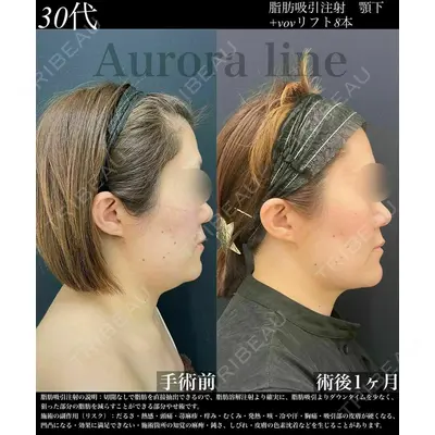 湘南美容クリニック 秋葉原院の症例