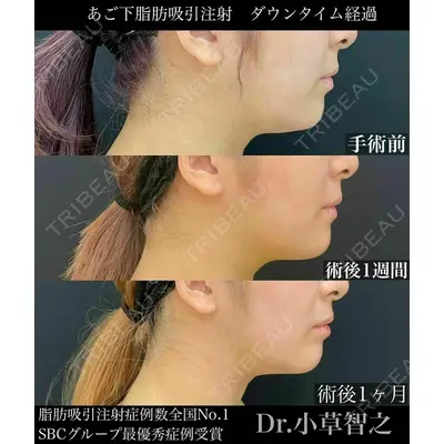 湘南美容クリニック 秋葉原院の症例