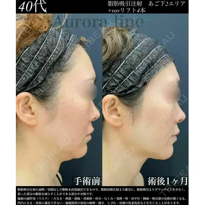 湘南美容クリニック 秋葉原院の症例