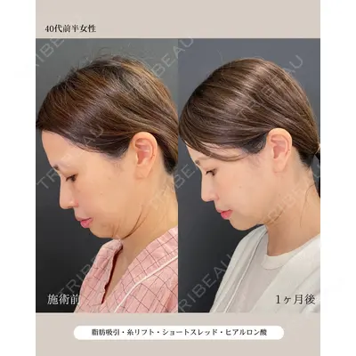 自由が丘ウェルエイジングビューティークリニック 福田 知佐子医師の症例