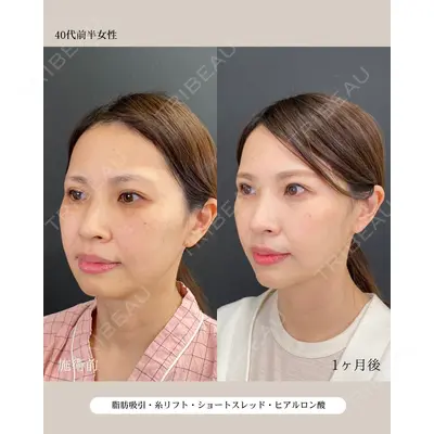 自由が丘ウェルエイジングビューティークリニック 福田 知佐子医師の症例