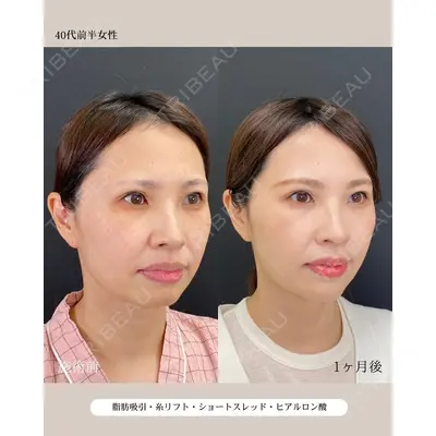 自由が丘ウェルエイジングビューティークリニック 福田 知佐子医師の症例