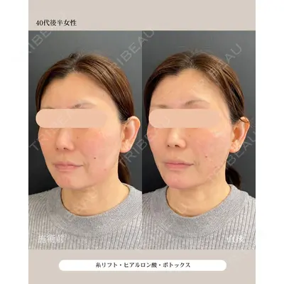 自由が丘ウェルエイジングビューティークリニック 福田 知佐子医師の症例
