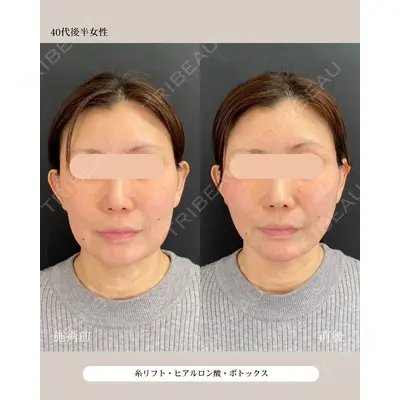 自由が丘ウェルエイジングビューティークリニック 福田 知佐子医師の症例
