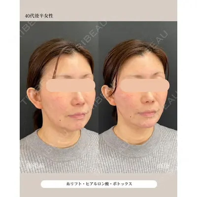 自由が丘ウェルエイジングビューティークリニック 福田 知佐子医師の症例