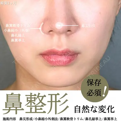 アリエル美容クリニック 大宮院 阪野 一世医師の症例