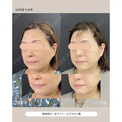 自由が丘ウェルエイジングビューティークリニック 福田 知佐子医師の症例