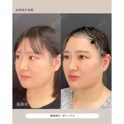 自由が丘ウェルエイジングビューティークリニック 福田 知佐子医師の症例