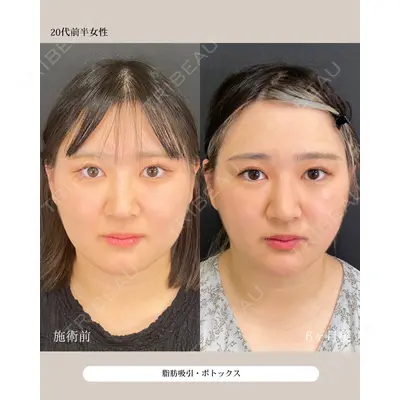 自由が丘ウェルエイジングビューティークリニック 福田 知佐子医師の症例