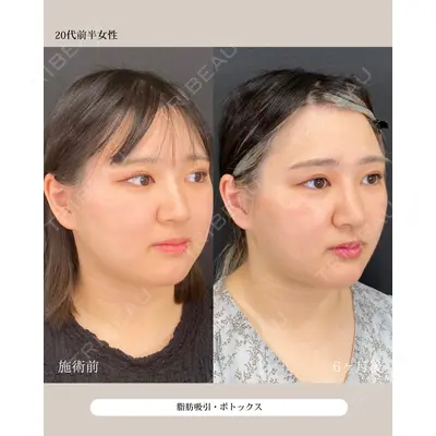 自由が丘ウェルエイジングビューティークリニック 福田 知佐子医師の症例