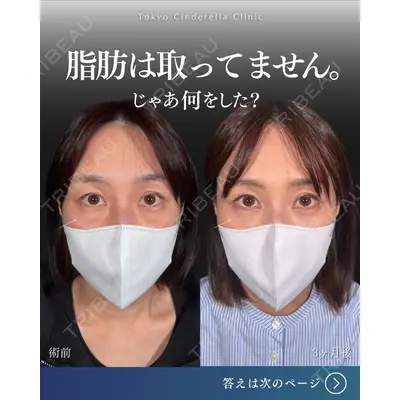 東京シンデレラ美容外科  横浜院 吉田 利之医師の症例