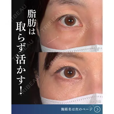 東京シンデレラ美容外科  横浜院 吉田 利之医師の症例