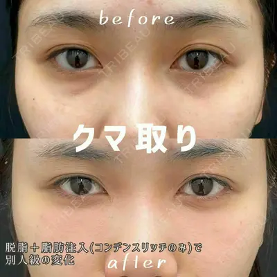 湘南美容クリニック 浜松院の症例