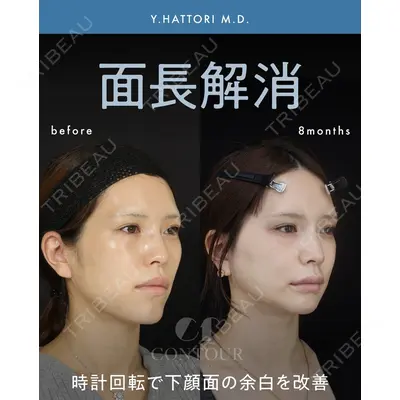 コントアクリニック 東京 服部 貴続医師の症例