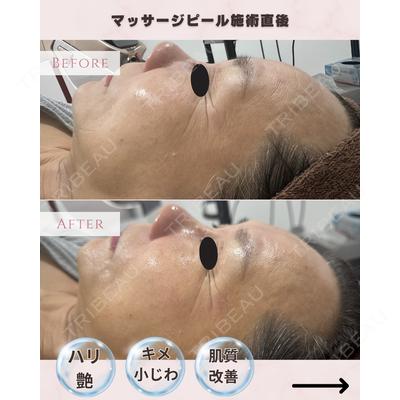 滋賀美容皮膚科クリニックの症例