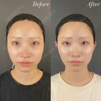 R Beauty CLINIC 名古屋院 木村 尚大医師の症例