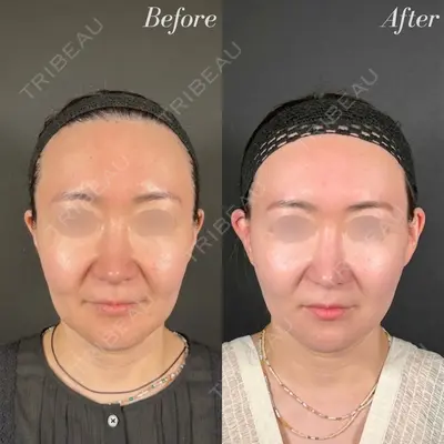 R Beauty CLINIC 名古屋院 木村 尚大医師の症例