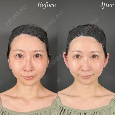 R Beauty CLINIC 名古屋院 木村 尚大医師の症例