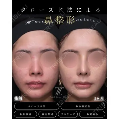 Zetith Beauty Clinic 福岡院 羽根 和秀医師の症例