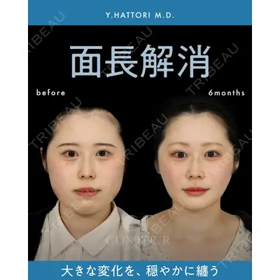 コントアクリニック 東京 服部 貴続医師の症例