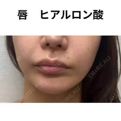 おおたかの森ビューティークリニック 海野 芙美香医師の症例