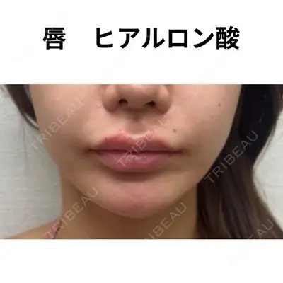 おおたかの森ビューティークリニック 海野 芙美香医師の症例